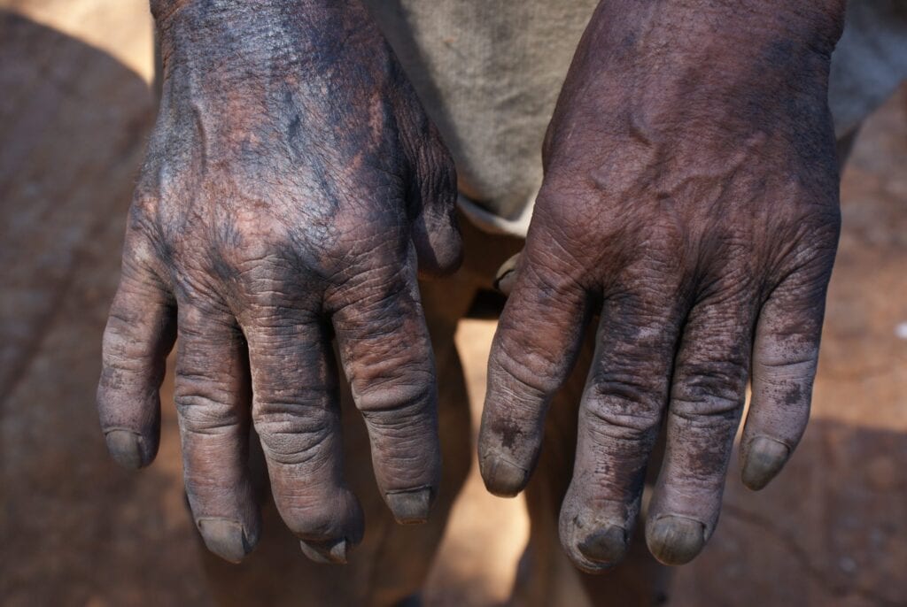 O trabalho escravo põem em risco a saúde e a vida dos trabalhadores. Foto: STEFANO WROBLESKI/REPÓRTER BRASIL